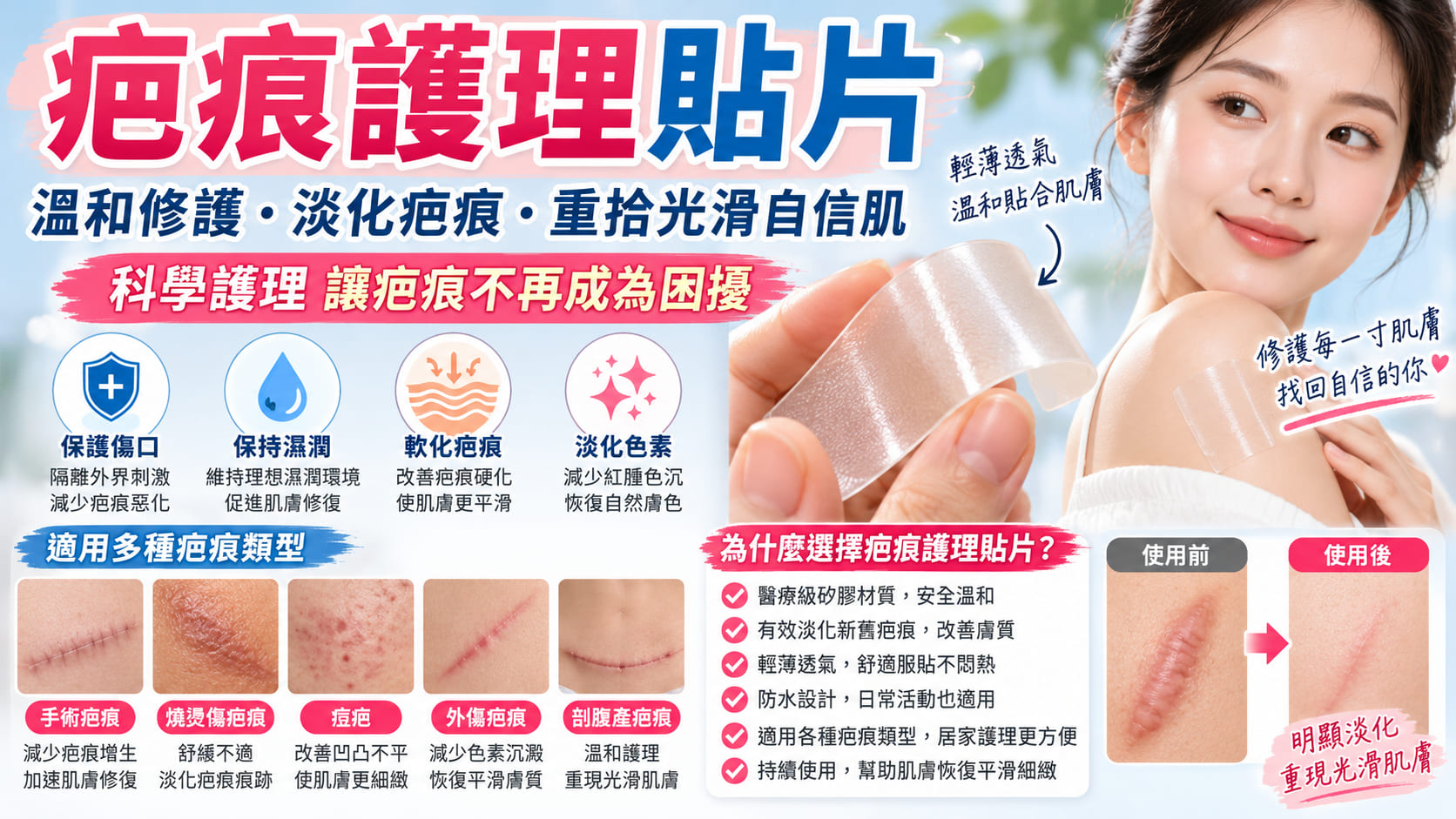 疤痕護理貼片有用嗎?適用疤痕、使用方法與注意事項一次看